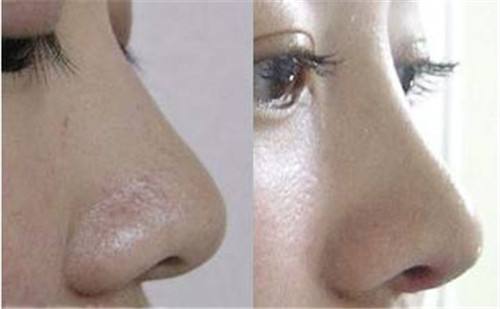 2023年北京填充川字紋凹陷醫(yī)療美容院排名前10的優(yōu)秀口碑醫(yī)院推薦，快速記錄！