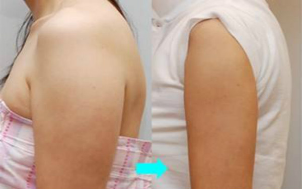 天津哪些整形美容醫(yī)院提供卓越的線雕去眼紋技術(shù)？2023比較推崇的天津線雕去眼紋前十佳整形醫(yī)院盤點(diǎn)！