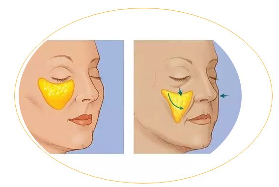 滄州哪家醫(yī)院治痘痘靠譜？推薦2023年口碑前十的權(quán)威整形美容醫(yī)院！