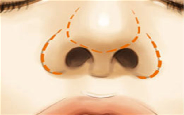 成都老年斑淡化的高級整形醫(yī)院哪家口碑比較好？最新排名公布！