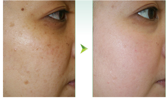 上海無針去淚溝整形醫(yī)院排行榜2023：口碑爆棚的十大醫(yī)院揭秘！