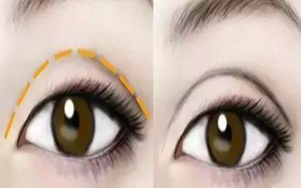 2023年南昌超皮秒去細(xì)紋排行榜公布！10家備受口碑推崇的整形美容醫(yī)院揭曉！