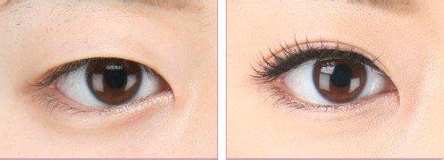 重慶有哪些口碑好的射頻點陣激光祛除疤痕醫(yī)療美容醫(yī)院？2023年排名前十的醫(yī)院哪家服務(wù)較佳？