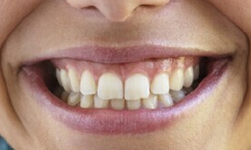 鄭州水動(dòng)力抽脂瘦小腿醫(yī)生