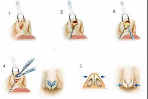 2023常德哪里可以做到去額頭紋的皮秒整形美容醫(yī)院排行榜前10強露面！