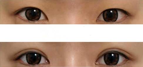 佛山口周紋有哪些醫(yī)院可以進(jìn)行活細(xì)胞治療？2023排名前10的專業(yè)機構(gòu)精選！