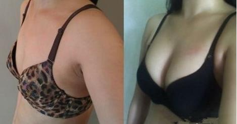 2023年武漢微雕點(diǎn)陣去疤痕十大口碑權(quán)威整形醫(yī)院揭秘！