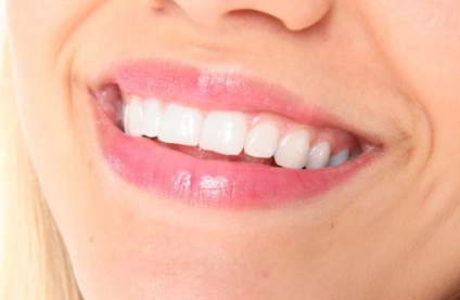 2023年，石家莊非常受歡迎的動態(tài)細(xì)紋醫(yī)院排行榜前十震撼發(fā)布！