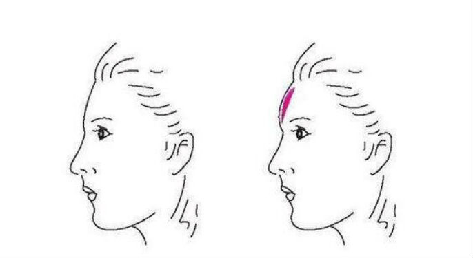 2023年安康市排名前10的專業(yè)整容醫(yī)院，注射自體脂肪顆粒豐顳術(shù)技術(shù)好！