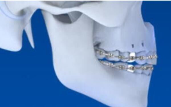 2023北京市面部整形醫(yī)院精心推薦，挑選您滿意的五官整形機構(gòu)！