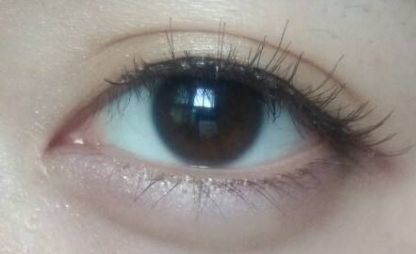 2023年強勢來襲！德州整形醫(yī)院推出全臉去痣首選，前十強榮耀問世！