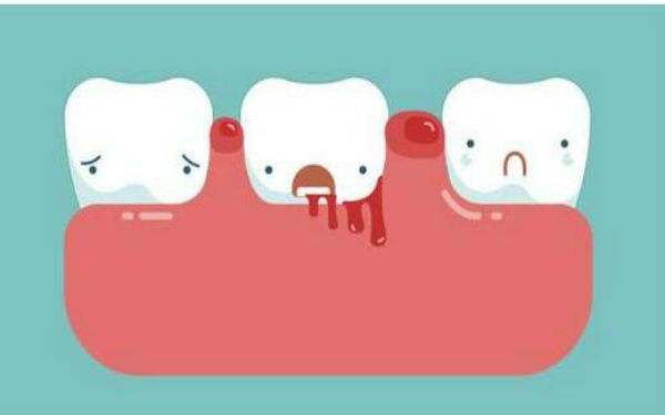 三亞微創(chuàng)定位除皺術(shù)醫(yī)生