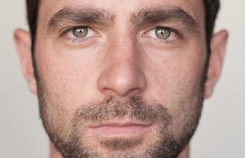 重慶點(diǎn)痣手術(shù)醫(yī)生