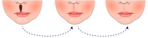 青島哪家醫(yī)院的微雕去眉間紋效果好？2023年排名前十實(shí)力醫(yī)院推薦！