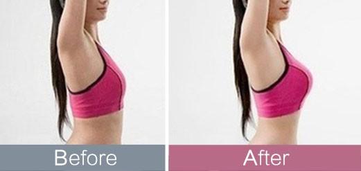 揭秘2023深圳治療抬頭紋熱門醫(yī)院排行榜top10！這些明星醫(yī)院廣受推崇，種草不斷！