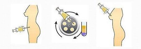 上海哪家整形醫(yī)院治療生長紋比較好？2023最可靠的前十強醫(yī)院有哪些？
