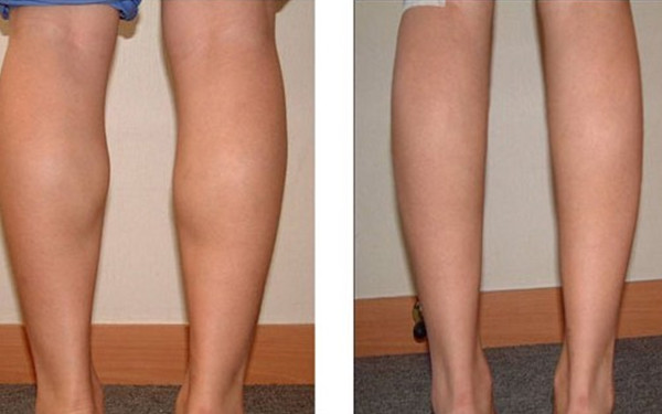 重慶哪家醫(yī)院是2023年瘦臉整形的首選？排名前十的可靠醫(yī)院評測！