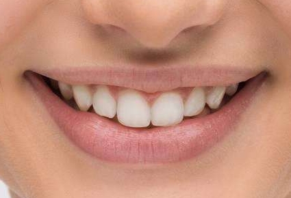 2023開封高性價(jià)比的眼角紋射頻祛除醫(yī)院排行榜TOP10已公布！