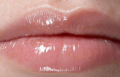 蘭州比較靠譜的去口周紋整形醫(yī)院是哪家？2023年蘭州去除口角紋綜合排名揭曉，這幾家口周紋醫(yī)療整形醫(yī)院實(shí)力