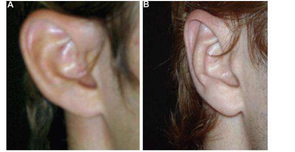 鄭州治療老年斑有口碑的整形醫(yī)院推薦！附2023年鄭州消除老年斑前十強(qiáng)排行！