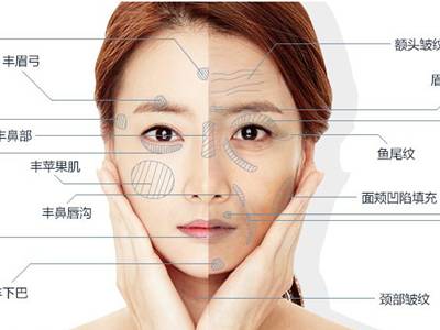 廣州臉部打溶脂針排名前10的美容醫(yī)院口碑大揭秘！2023年很受好評(píng)的整形醫(yī)院技術(shù)盤(pán)點(diǎn)！