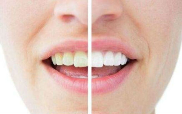 深圳豐太陽穴整形醫(yī)院口碑非好好！2023年十佳面部注射豐太陽穴醫(yī)院排名出爐