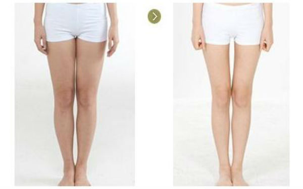 2023南京軟骨+膨體材料隆鼻，這些整形醫(yī)院值得選擇