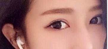 2023年山東哪些醫(yī)療美容醫(yī)院推薦度高，專業(yè)祛除眼周紋的前十家？