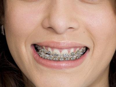 保定地區(qū)超聲炮祛額頭紋整形醫(yī)院哪些？2023排名榜前十引領(lǐng)行業(yè)