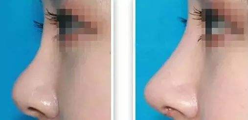 2023寧波頭部皺紋祛除醫(yī)院口碑排行榜top10公開總結(jié)！