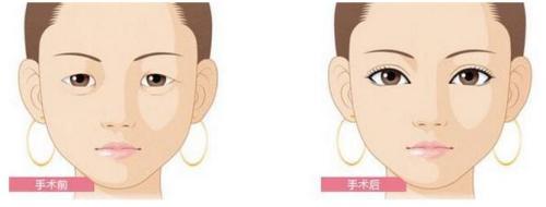 濟(jì)南哪些整形醫(yī)院在動(dòng)態(tài)細(xì)紋手術(shù)方面非常權(quán)威？2023年濟(jì)南十大專(zhuān)業(yè)動(dòng)態(tài)細(xì)紋手術(shù)醫(yī)院評(píng)測(cè)報(bào)告來(lái)襲！