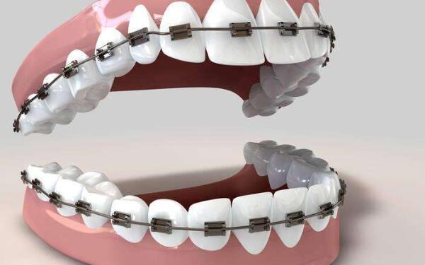 杭州冰點脫毛醫(yī)院排名前10，揭秘2023年的榜單！