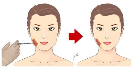 成都隆鼻整形醫(yī)院TOP10名單公布，2023年最受贊譽的美容醫(yī)院詳細概況！