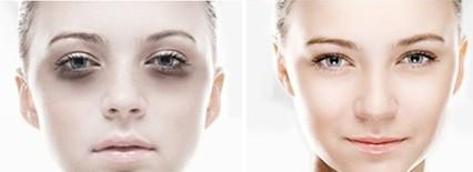 北京哪些醫(yī)院的激光去黑頭效果好？2023年排名前10的強(qiáng)整形醫(yī)院推薦！