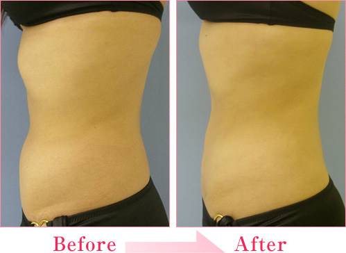 2023年，桂林哪家醫(yī)療整形醫(yī)院排名前十的專業(yè)眼紋去除法整形醫(yī)院