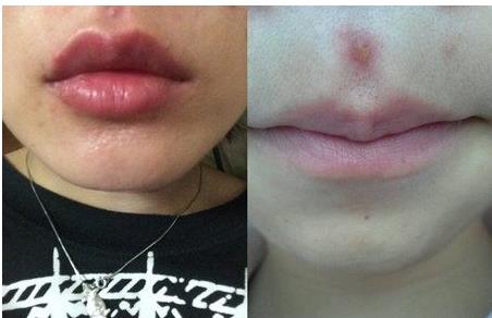 2023青島哪些醫(yī)院口碑好，提供專業(yè)的提拉魚尾紋醫(yī)療美容服務(wù)？青島魚尾紋醫(yī)院TOP10強機構(gòu)推薦