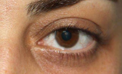 唐山哪家專業(yè)整形醫(yī)院在韓式微創(chuàng)雙眼皮恢復(fù)方面經(jīng)驗(yàn)豐富？2023年唐山醫(yī)療整形院雙眼皮恢復(fù)排名前十可信賴嗎