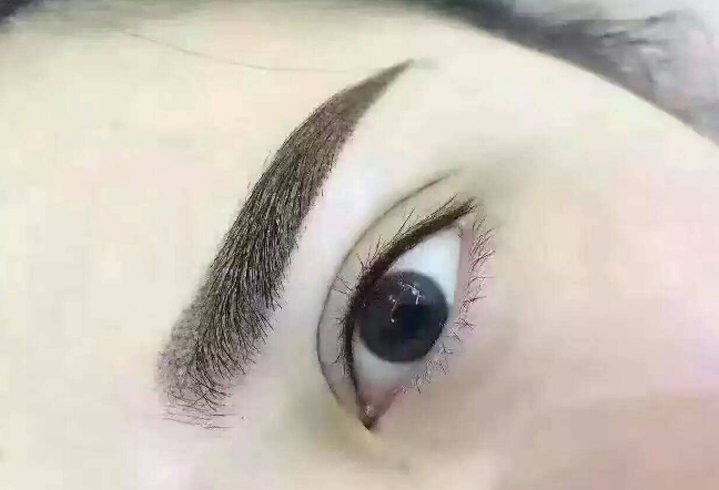 鄭州眉間紋淡化，2023年十大整形美容醫(yī)院推薦