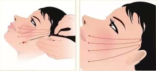 邵陽(yáng)點(diǎn)陣祛妊娠紋：2023TOP10深度調(diào)查，揭秘專(zhuān)家推薦的正規(guī)整形醫(yī)院！