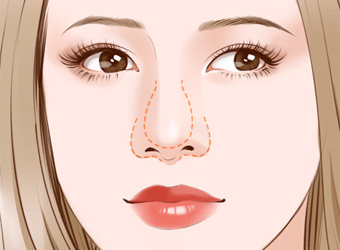 湖州超聲波去眼袋整形美容醫(yī)院排名揭曉！2023年比較推崇的湖州去眼袋醫(yī)院前十強+綜合口碑