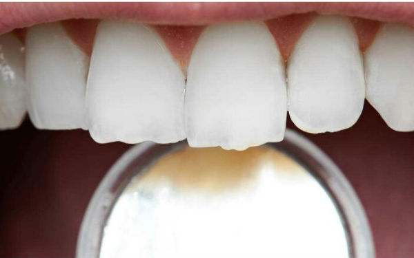 2023年哪家醫(yī)院在鎮(zhèn)江做水動力抽脂瘦腰效果比較好？TOP10整形醫(yī)院發(fā)布！