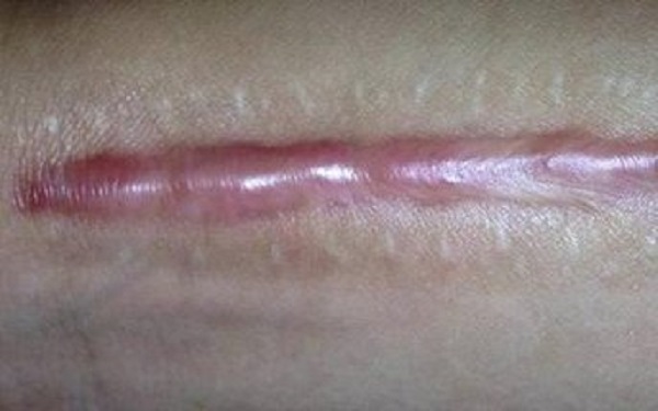 2023蘇州面部皺紋填充醫(yī)院排名揭曉！哪家醫(yī)院在皺紋填充領(lǐng)域名列前茅？