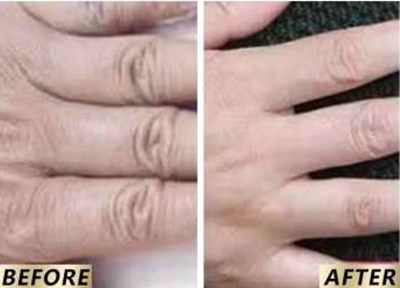 【2023非常受歡迎】南京高質(zhì)量魚尾紋激光去除醫(yī)院排行榜TOP10公布！看看有哪些值得去的！