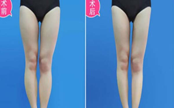 天津哪家整形醫(yī)院效果好？2023年天津太田痣激光治療正規(guī)醫(yī)院口碑前幾實力不一！