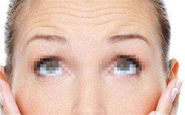 西安治療面部皺紋的著名醫(yī)院推薦！2023年排名前十，絕對(duì)值得考慮！