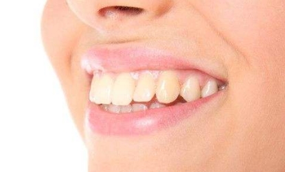 2023杭州口周紋整形醫(yī)院口碑好的有哪些？杭州物理去口周紋醫(yī)院排名揭曉！