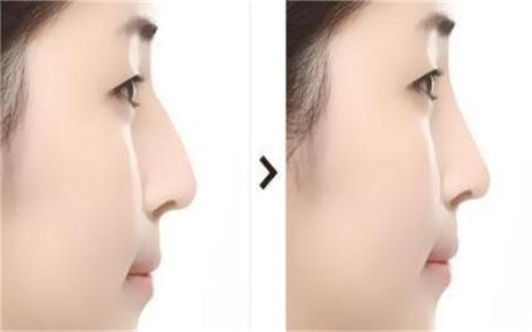 2023年中回顧！阜陽注射祛疤痕領域權威整形美容醫(yī)院排行榜TOP10強揭曉！