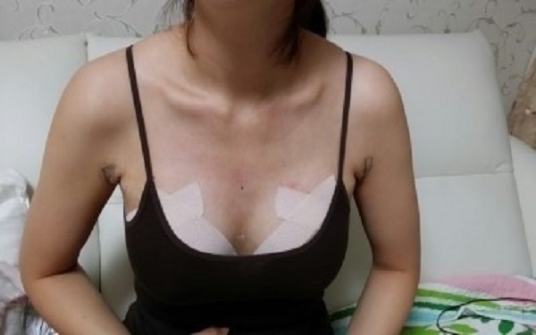 2023年北京注射脂肪隆胸醫(yī)院排名top10，讓你不再為選擇糾結(jié)！