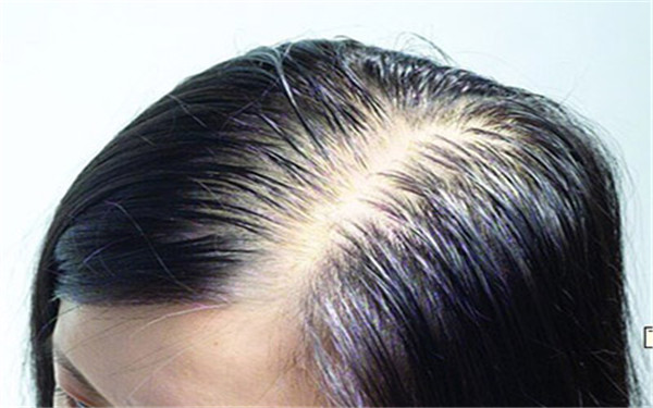 2023年莆田除皺醫(yī)院排行榜前十強(qiáng)，這些醫(yī)院的口碑如何？