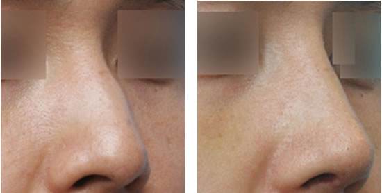 長沙法令紋填充，2023年10家美容醫(yī)院排名榜單發(fā)布